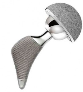 A metallic hip joint implant with a textured stem and rounded socket.
