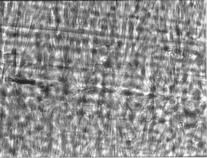 Micrograph of polypropylene, the material used in some meshes