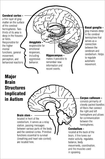 Autism brain