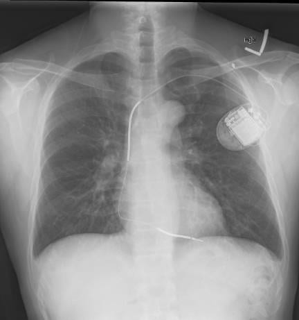 Courtesy of Gregory Marcus, MD, MAS, FACC Courtesy of Gregory Marcus, MD, MAS, FACC