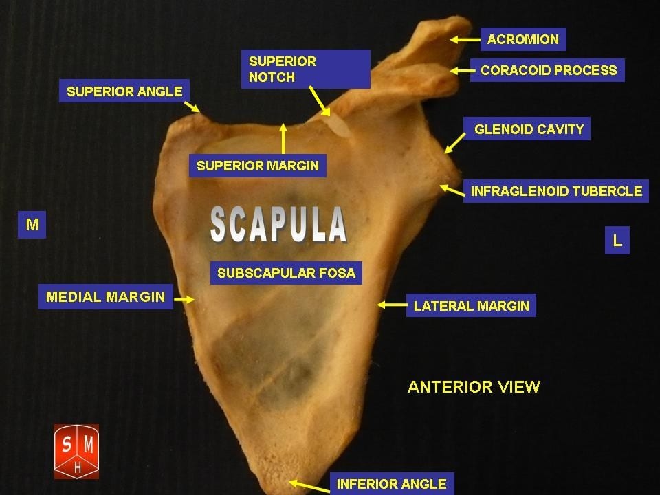 shoulder implant