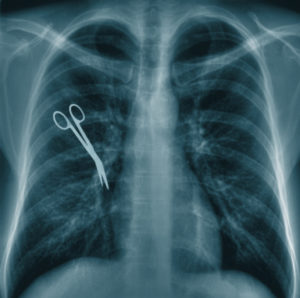 X-ray of chest revealing medical negligence: surgical scissors left near the lungs.