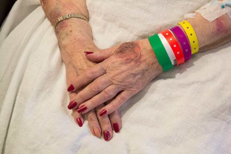 Bruised Hands of Elderly Woman