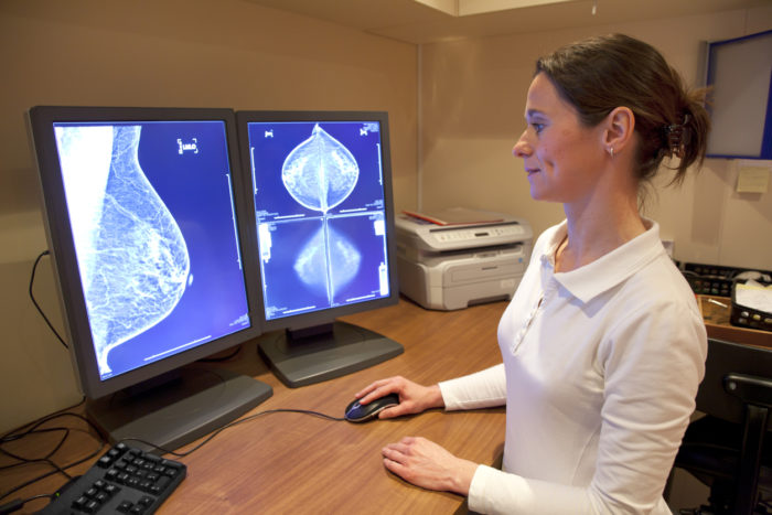 south florida breast exams -- mammogram quality in question
