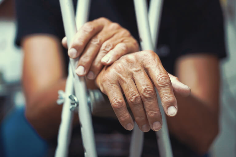 Injured Man With Crutches