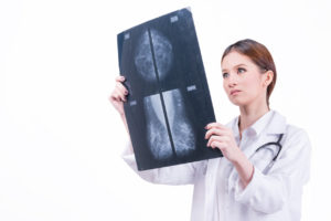 Doctor examines a mammogram X-ray image against a white background.