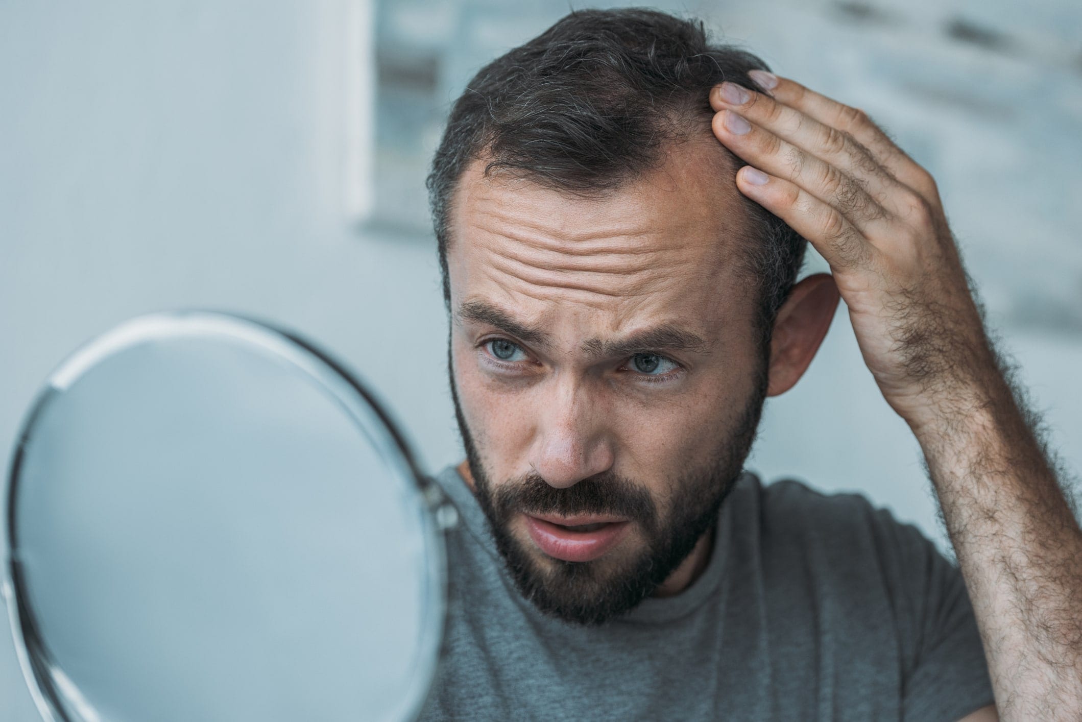 Man looking in mirror checking hair loss