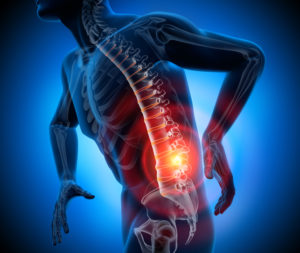 3D illustration of a person with highlighted lower spine pain in the back.